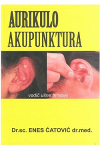 Aurikulo akupunktura